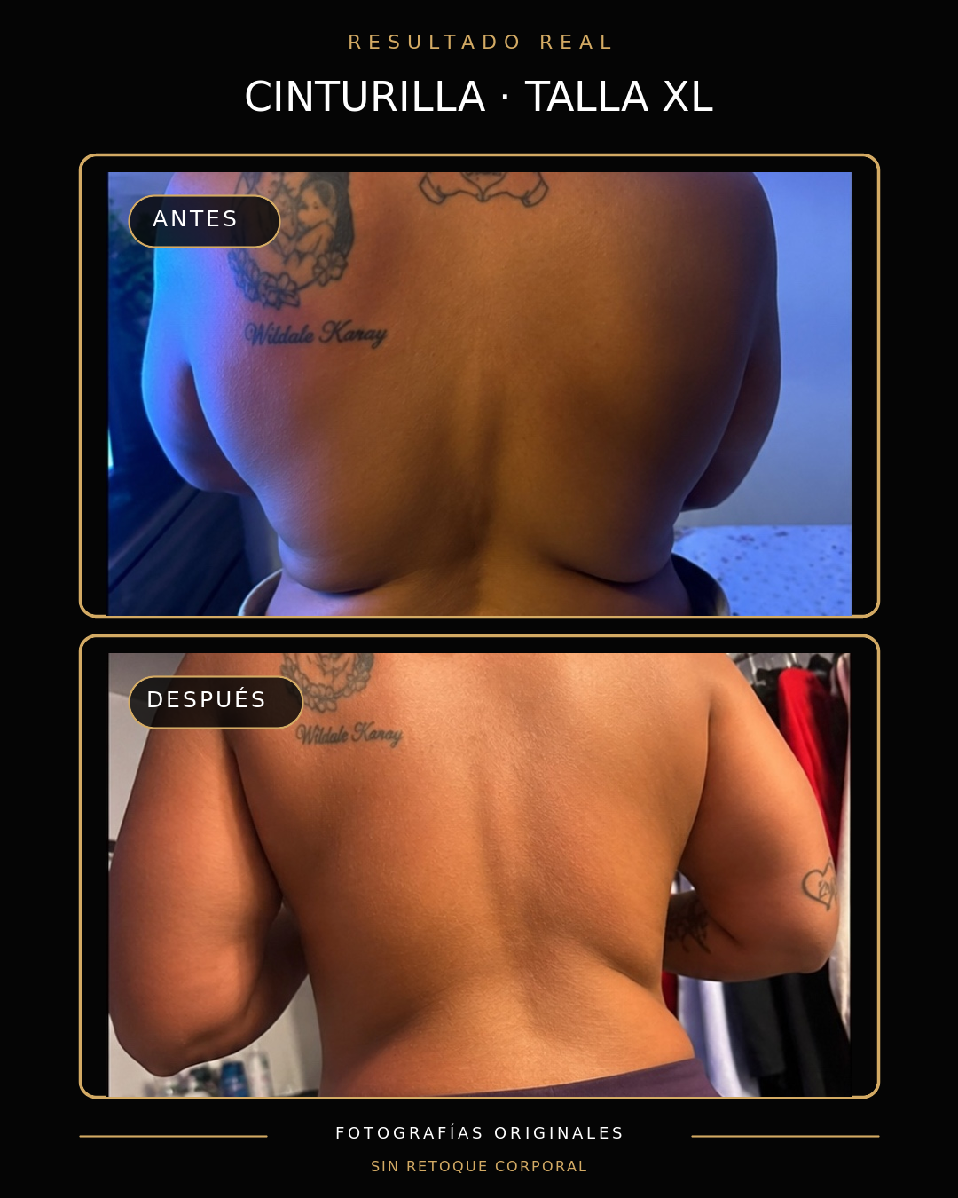 Resultado real de clienta talla XL presentado para ariiSKIN